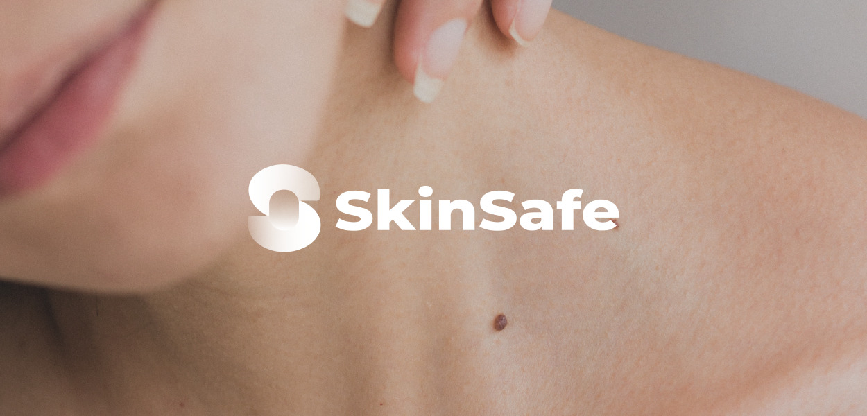 SkinSafe logo on person with skin mole